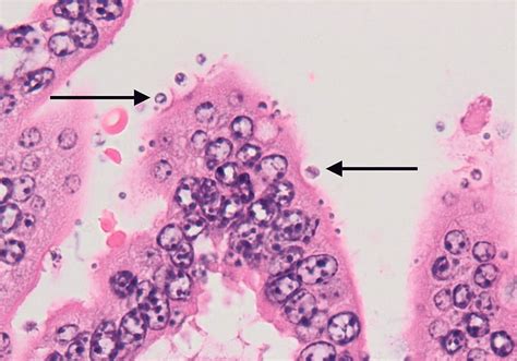 Cryptosporidium! A Microscopic Marvel Unveiled: Tiny Parasite Lives and Thrives Within Hosts' Intestines