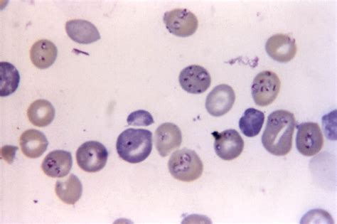  Babesia! Bu Parazit Protozoanın Hayatı Neden Sizi Şaşırtabilir?