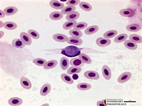  Leucocytozoon! A Microscopic Hitchhiker That Thrives on Avian Blood