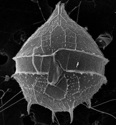  Peridinium! Bu Deniz Canavarının Mikroskop Altındaki Gizli Dünyasını Keşfetmek İster misiniz?