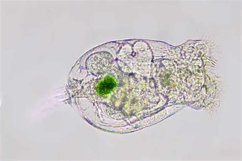  Rotifera! Hayvan Krallığının En Küçük Ve Şaşırtıcı Yaratıklarından Birinin Gizemli Dünyasına Yolculuk