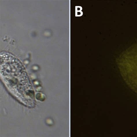  Tetrahymena: Bir Hücre İçinde Dans Eden Mikrokozmos!