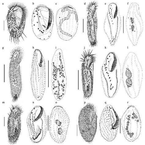  Xorticoxa:  Explore the Microscopic World of a Free-Living Ciliate with Exquisite Morphology!