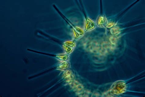  Zoochlorella: A Tiny Algae Powerhouse That Embraces Photosynthesis and Lives Inside Other Creatures!